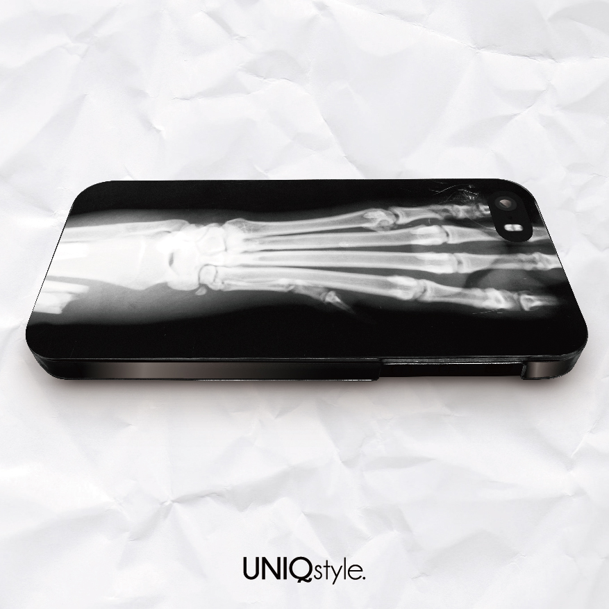 Stylish Xray phone case for iPhone 7/6/6s , Samsung S8/S7/S6/Note5