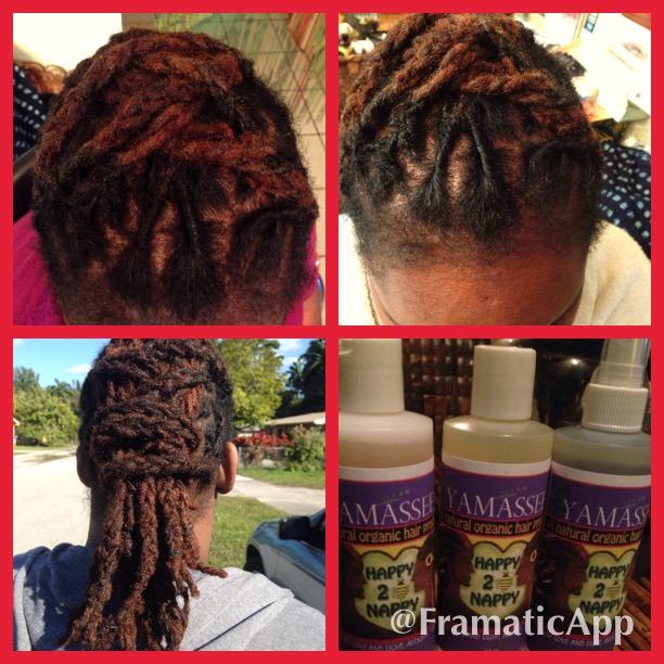 4 Dry Scalp Hair Oil Happy 2be Nappy Online Store Powered